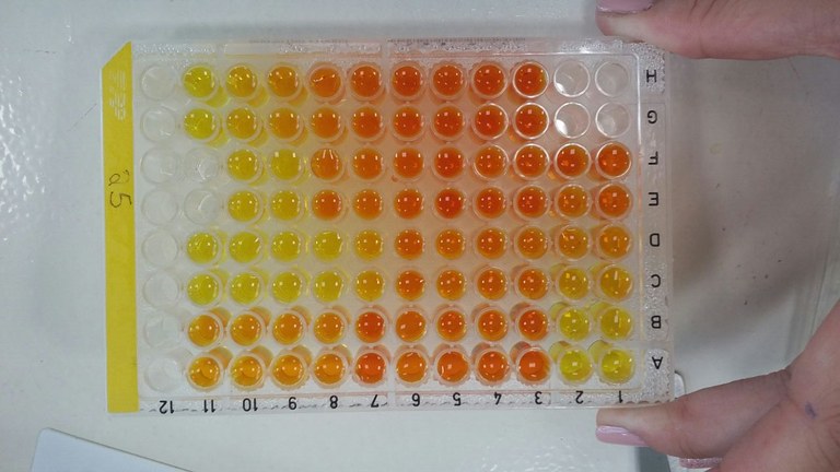 Imagem mostra mão segurando placa com 96 poços, alguns preechidos com líquido de cores alaranjada e amarela